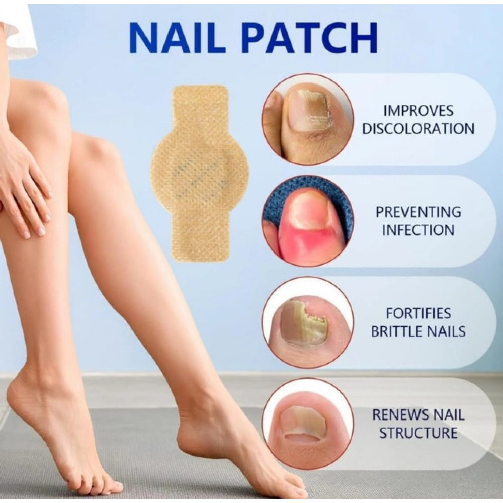 Generic Fungal Nail Patches (Yellow)